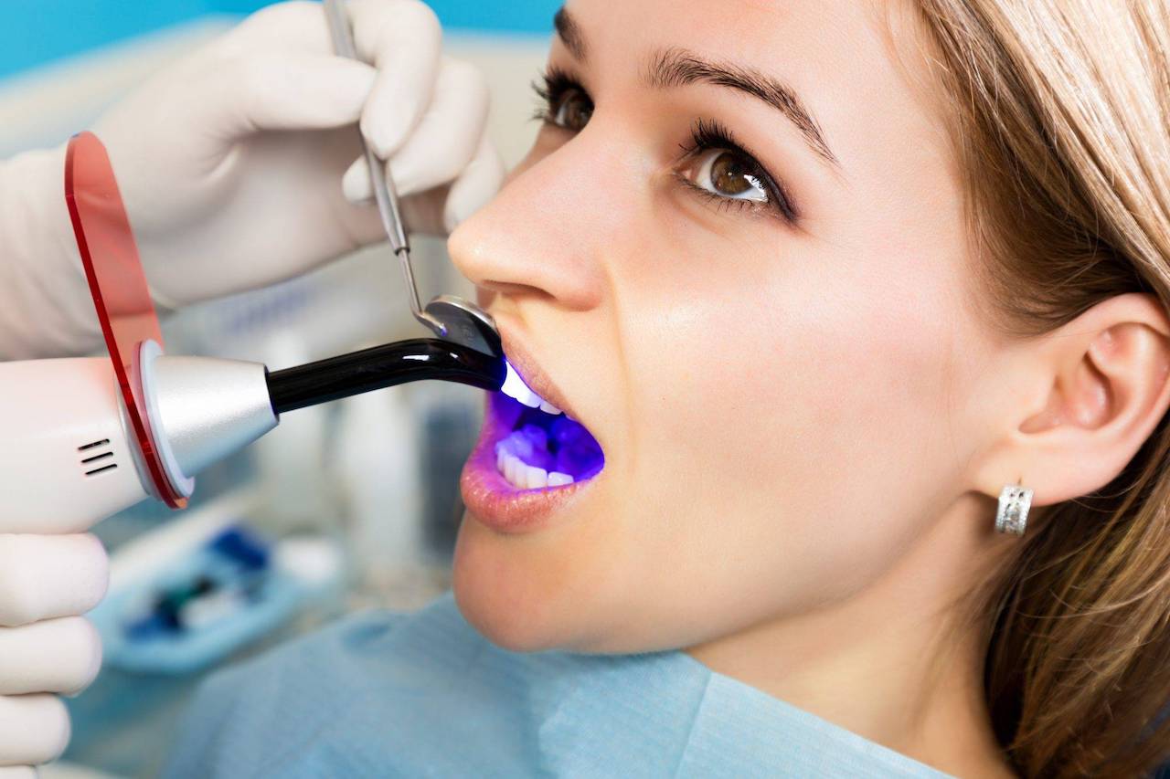 A cosa serve l’impronta dentale digitale acquisita con scanner intraorale | Dott.ssa Claudia Crestale